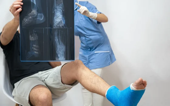 Bone Fracture X-ray